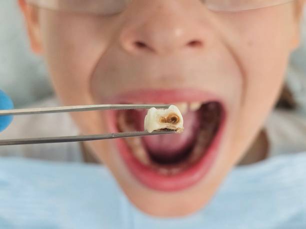Best Emergency TMJ Treatment in Browns Point, WA